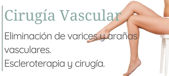 Cirugía Vascular en Gijón Escleroterapia Varices