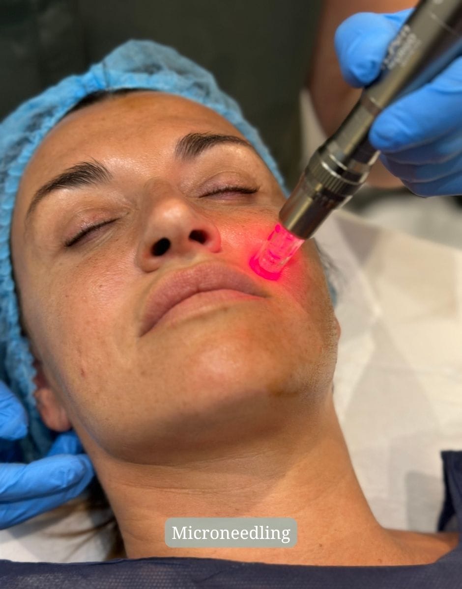 Tratamiento Estéticos Avanzados en Clínica Jovellanos en Gijón