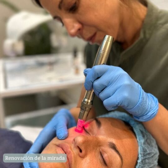 Tramiento Indiba Facial