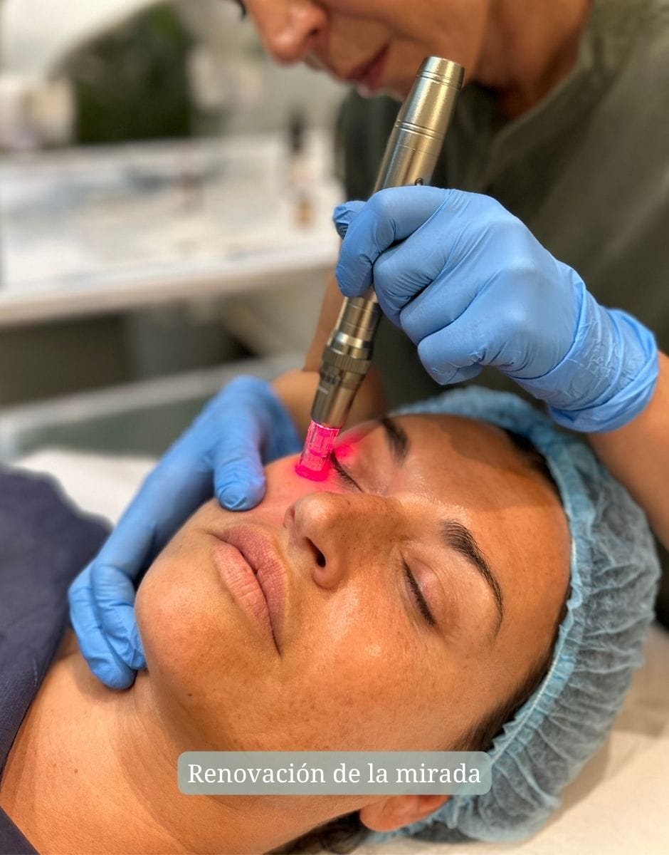 Tratamiento Estéticos Avanzados en Clínica Jovellanos en Gijón