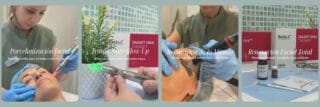 Imagen con los principales tratamientos estéticos faciales de Clínica Jovellanos en Gijón, Asturias: porcelanización facial, Glow Up, renovación de la mirada y renovación facial total.